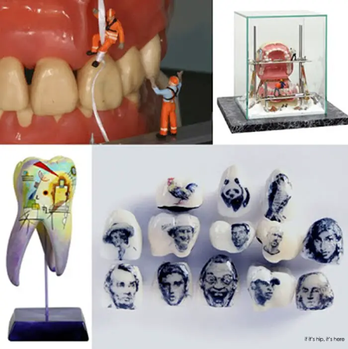 Tooth Tattoos and Dental Office Art