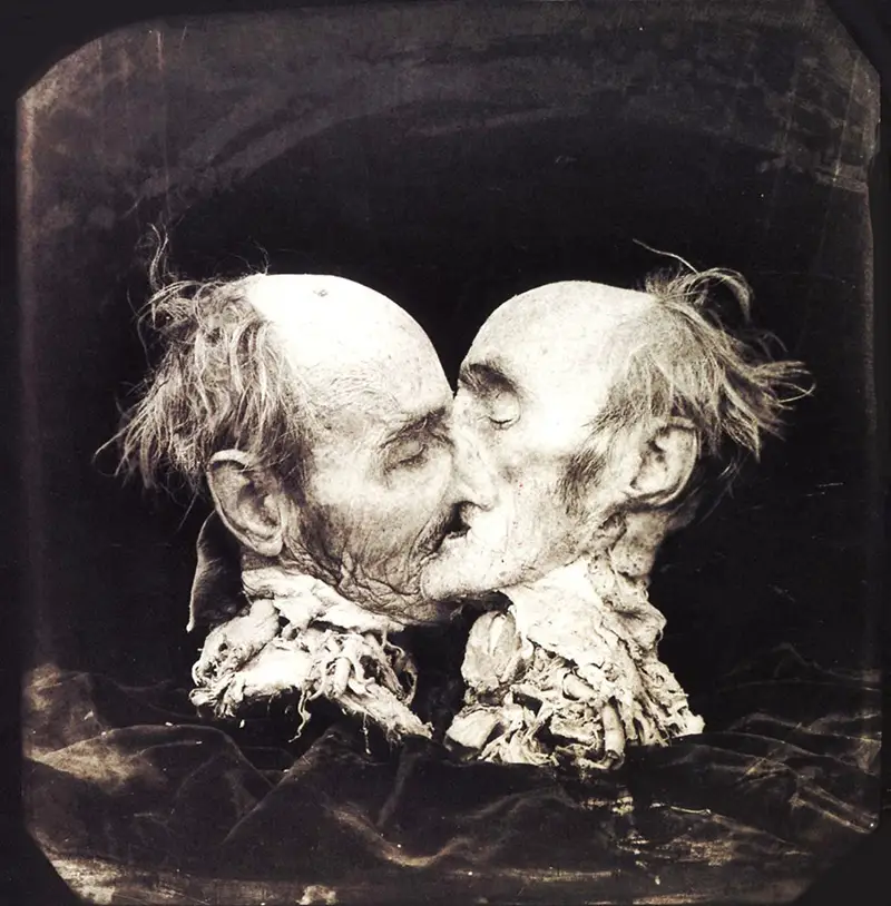 Joël Peter Witkin, The Kiss, 1982