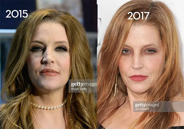 Lisa Marie Presley's Changing Looks in 2015 and 2017