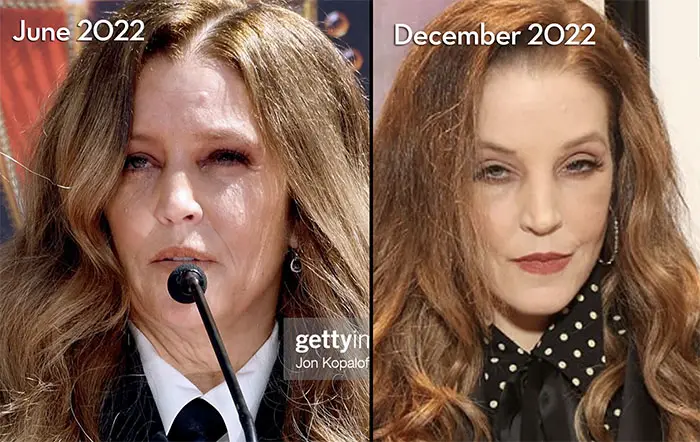 Lisa Marie Presley's Changing Looks in June of 2022 and in December of 2022